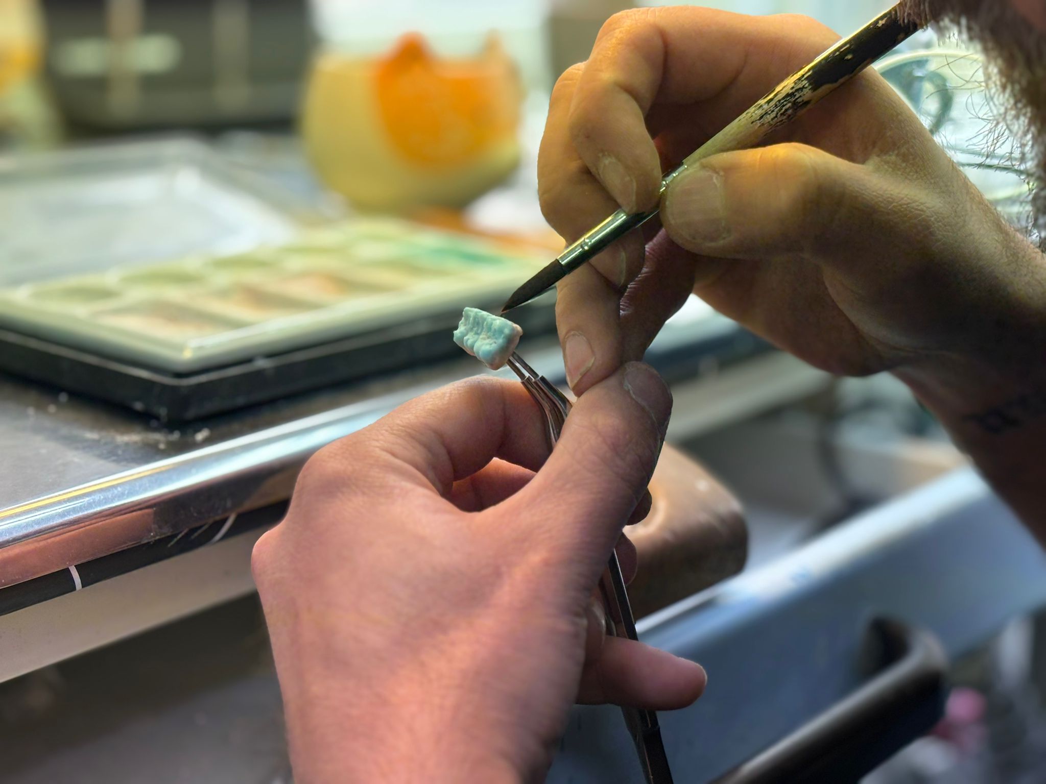 Prothèse dentaire céramique réalisée par le laboratoire Labotec à Nanterre