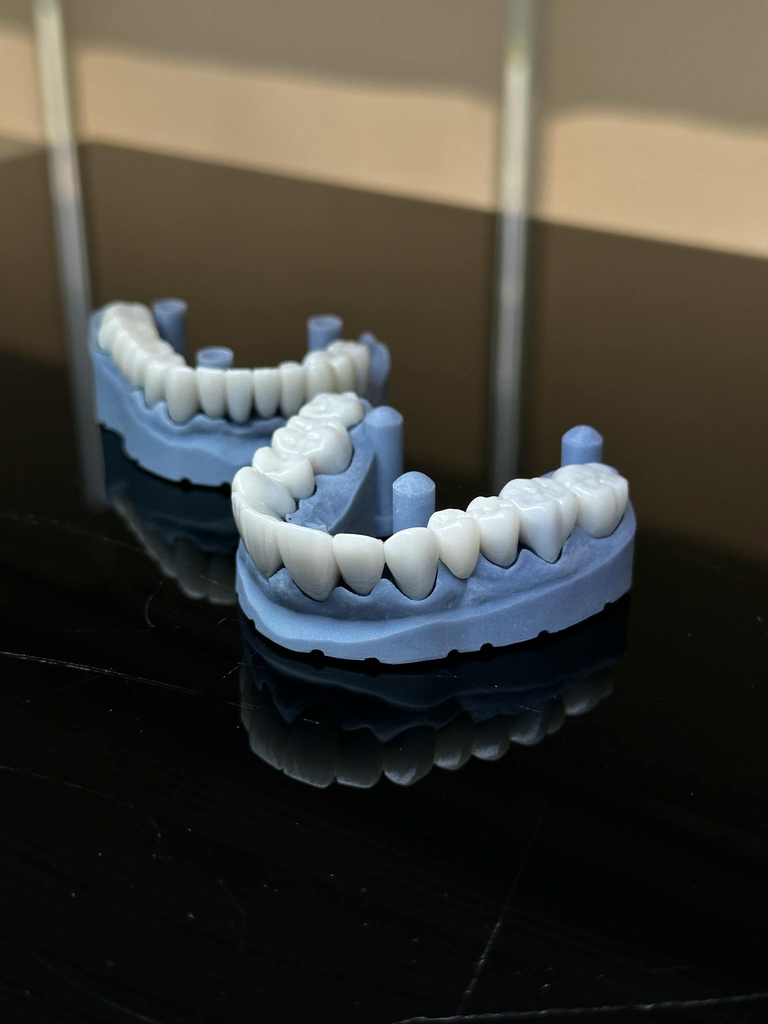 Close-up of dental models, highlighting tooth alignment and structure on a glossy surface.